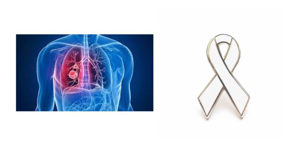  - Le 1er août 2023 - Journée mondiale du cancer du poumon : le point sur le diagnostic précoce