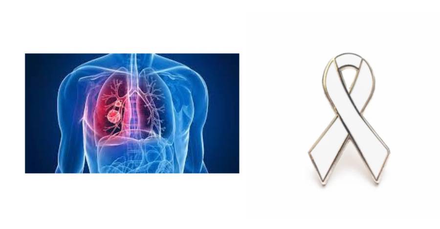 - Le 1er août 2023 - Journée mondiale du cancer du poumon : le point sur le diagnostic précoce